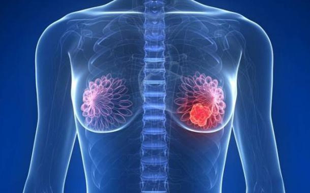 乳腺结节形成的真相:中医如何化解体内积聚的‘垃圾’?