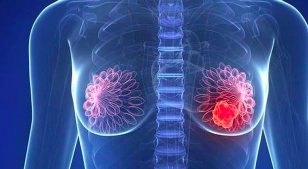 当身体出现“淤堵”:传统武医按跷如何应对乳腺结节
