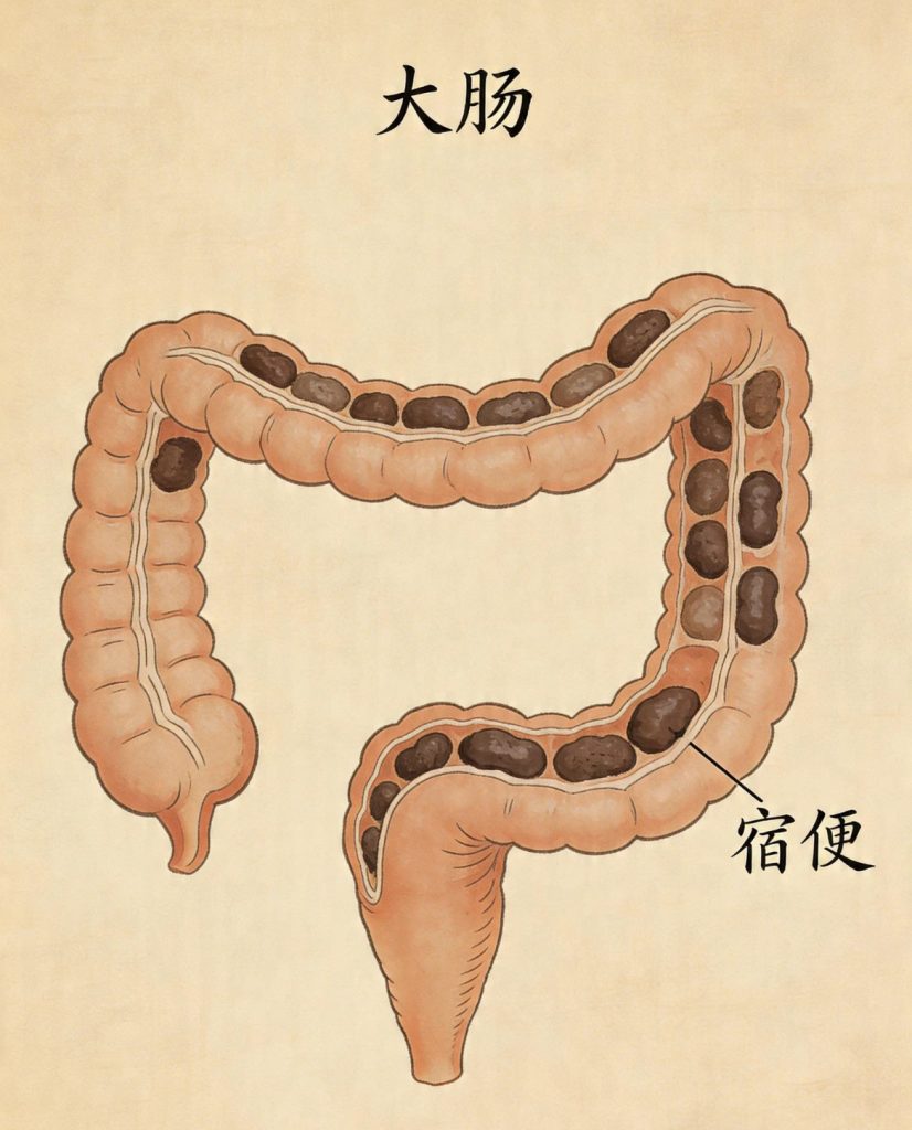 孩子起荨麻疹,怎么老是“拉不出屎”?峣华堂武医揭秘:肠道一通,皮疹自退